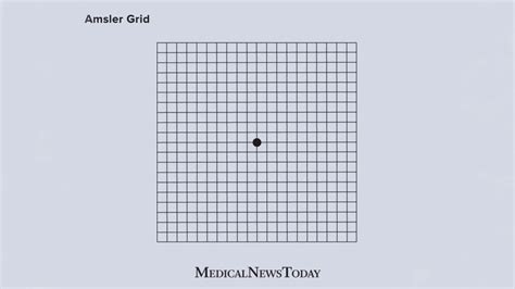 Amsler Grid: What It Is, How to Use It, and More .